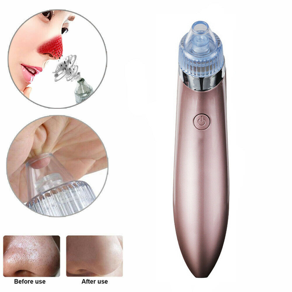 Electric Blackhead Vacuum Pore Cleaner Acne Pimple Remover Strong Suction Tool Electric Blackhead Remover Pore Vacuum Suction Diamond Dermabrasion Face Cleaner rechargeable