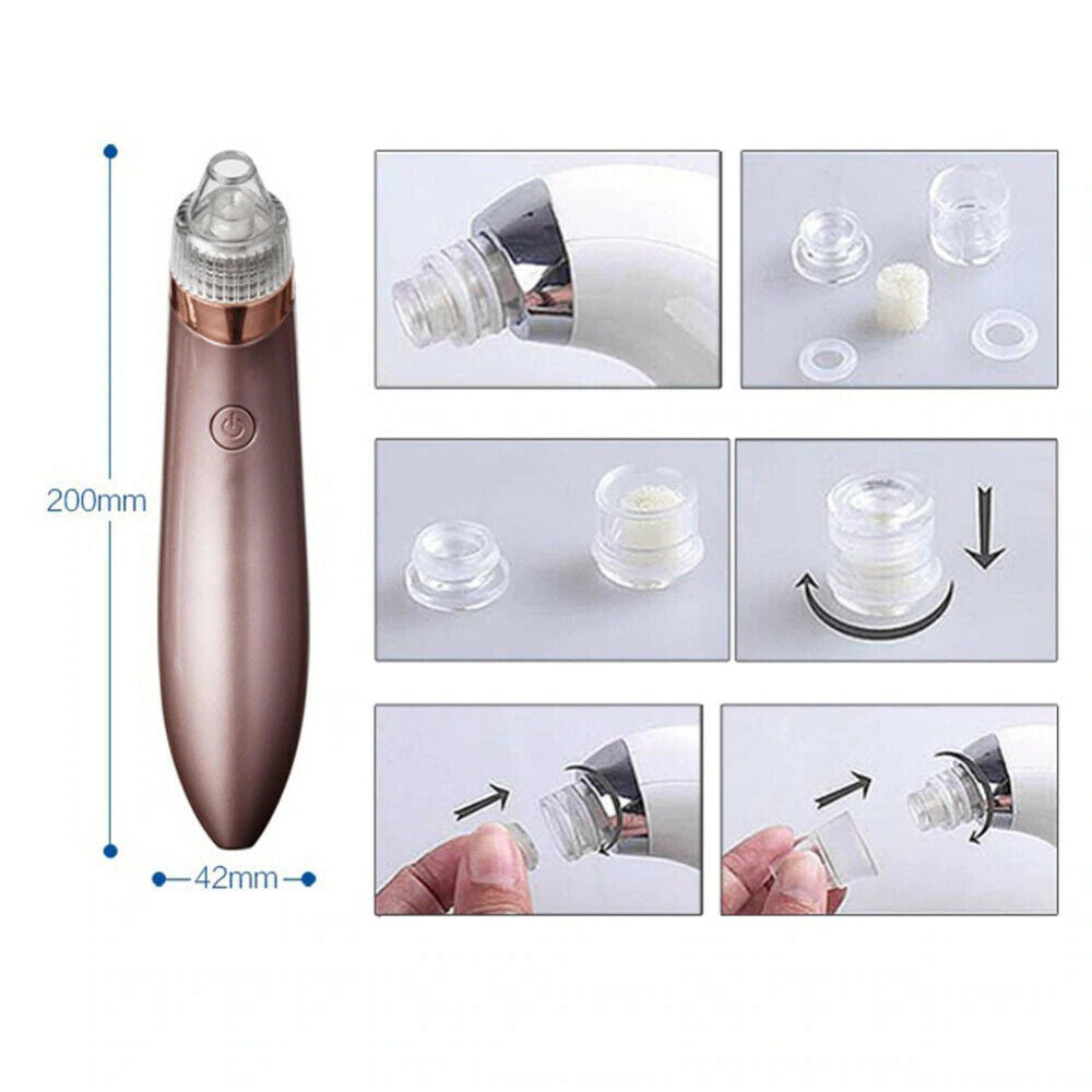 Electric Blackhead Vacuum Pore Cleaner Acne Pimple Remover Strong Suction Tool Electric Blackhead Remover Pore Vacuum Suction Diamond Dermabrasion Face Cleaner rechargeable