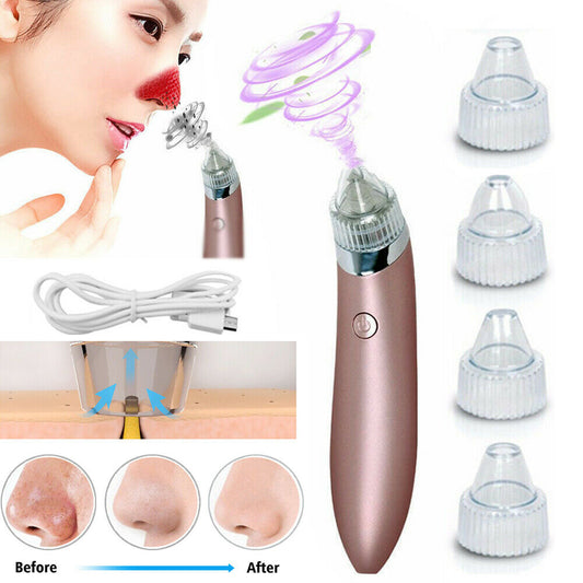 Electric Blackhead Vacuum Pore Cleaner Acne Pimple Remover Strong Suction Tool Electric Blackhead Remover Pore Vacuum Suction Diamond Dermabrasion Face Cleaner rechargeable